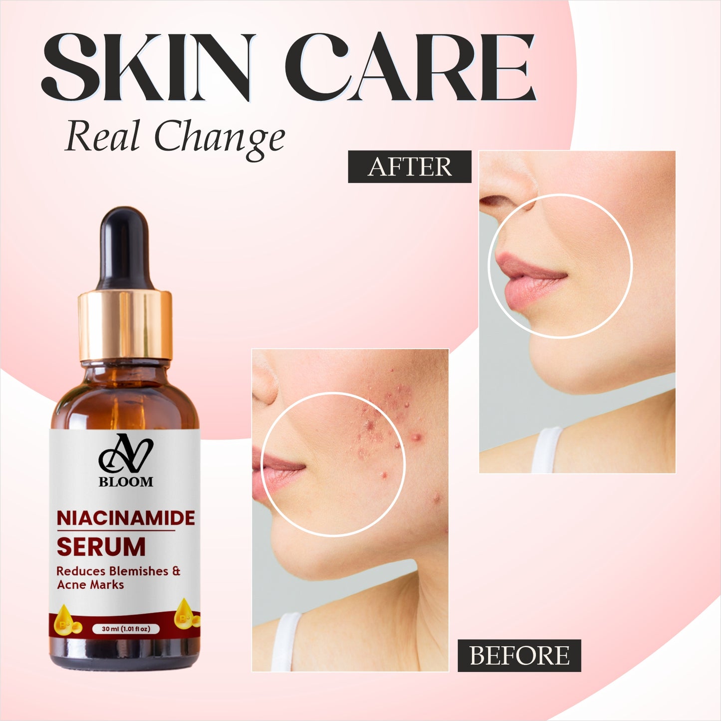 AV Bloom Niacinamide Serum for Reducing Blemishes & Acne Marks, 30ml (1.01 fl oz)