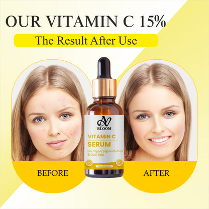 AV Bloom Vitamin C Serum for Hyperpigmentation & Dull Skin, 30ml (1.01 fl oz)
