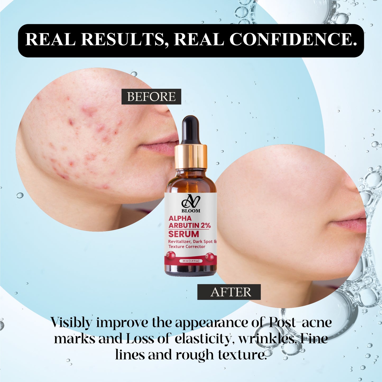 AV Bloom Alpha Arbutin 2% Serum, Revitalizer, Dark Spot & Texture Corrector, 30ml (1.01 fl oz)