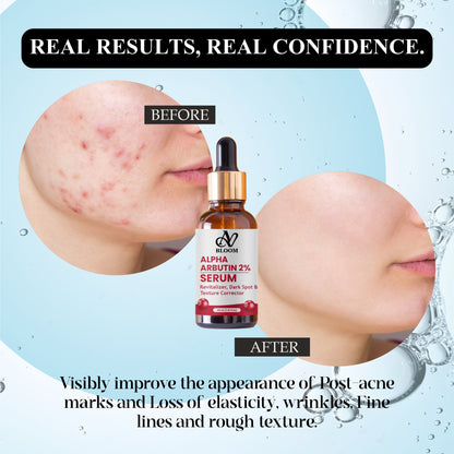 AV Bloom Alpha Arbutin 2% Serum, Revitalizer, Dark Spot & Texture Corrector, 30ml (1.01 fl oz)