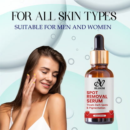 AV Bloom Spot Removal Serum, Treats Dark Spots & Pigmentation, 30ml (1.01 fl oz)