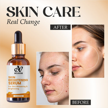 AV Bloom Skin Brightening Serum for Skin Whitening & Brightening with B14, 30ml (1.01 fl oz)