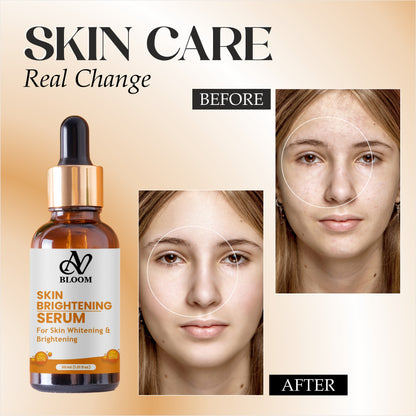 AV Bloom Skin Brightening Serum for Skin Whitening & Brightening with B14, 30ml (1.01 fl oz)